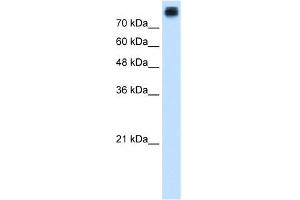 WB Suggested Anti-CDH3 Antibody Titration:  1. (P-Cadherin anticorps  (N-Term))
