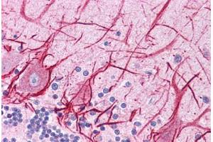 Human Brain, Cerebellum: Formalin-Fixed, Paraffin-Embedded (FFPE)