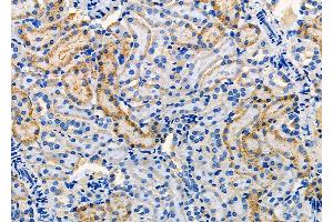 ABIN6260802 and ABIN6277859 at 1/100 staining Rat kidney tissue by IHC-P.