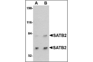 Western blot analysis of SATB2 in A20 cell lysate with this product at (A) 2 and (B) 4 μg/ml. (SATB2 anticorps  (C-Term))