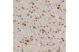 Immunohistochemical staining of human cerebral cortex with CC2D1B polyclonal antibody  shows moderate nuclear and cytoplasmic positivity in glial cells at 1:20-1:50 dilution. (CC2D1B anticorps)