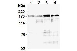 Western Blotting (WB) image for anti-Topoisomerase (DNA) II alpha 170kDa (TOP2A) (N-Term) antibody (ABIN1109282) (Topoisomerase II alpha anticorps  (N-Term))