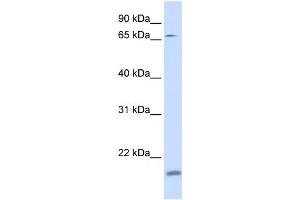 WB Suggested Anti-ZNF398 Antibody Titration:  0. (ZNF398 anticorps  (N-Term))