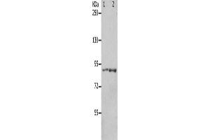 Gel: 8 % SDS-PAGE, Lysate: 40 μg, Lane 1-2: 293T cells, mouse brain tissue, Primary antibody: ABIN7191168(KCNC3 Antibody) at dilution 1/300, Secondary antibody: Goat anti rabbit IgG at 1/8000 dilution, Exposure time: 1 minute (KCNC3 anticorps)