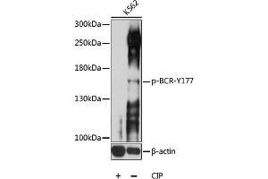 Western blot analysis of extracts of K562 cells, using Phospho-BCR-Y177 antibody (ABIN6135190, ABIN6136026, ABIN6136027 and ABIN6225622) at 1:1000 dilution. (BCR anticorps  (pTyr177))