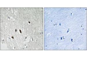 Immunohistochemistry analysis of paraffin-embedded human brain tissue, using RIPK2 (Ab-176) Antibody. (RIPK2 anticorps  (AA 146-195))