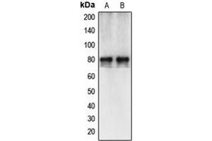 Western blot analysis of Calpain 12 expression in HepG2 (A), A549 (B) whole cell lysates. (CAPN12 anticorps  (Center))