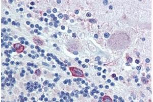 Anti-ERp72 antibody IHC staining of human brain, cerebellum. (PDIA4 anticorps  (AA 623-638))