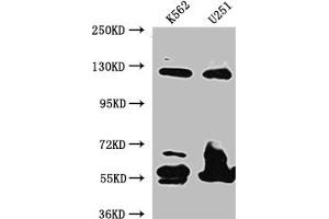 Western Blot Positive WB detected in: K562 whole cell lysate, U-251 whole cell lysate All lanes: BubR1 antibody at 1:1000 Secondary Goat polyclonal to rabbit IgG at 1/50000 dilution Predicted band size: 120, 106, 122 kDa Observed band size: 125 kDa (Recombinant BUB1B anticorps)