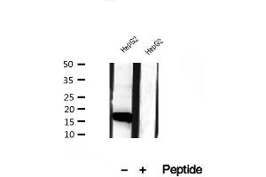 Western blot analysis of extracts of HepG2 cells, using CHCHD2 antibody. (CHCHD2 anticorps  (Internal Region))