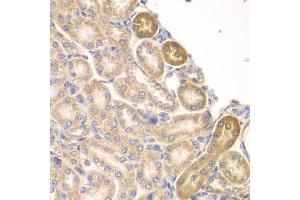 Immunohistochemistry of paraffin-embedded rat kidney using PIP4K2A antibody (ABIN6130624, ABIN6145673, ABIN6145674 and ABIN6223324) at dilution of 1:100 (40x lens). (PIP4K2A anticorps  (AA 120-350))