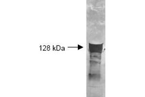 Both the antiserum and IgG fractions of anti-Glycerol Kinase (Cellulomonas) are shown to detect the 128,000 dalton enzyme in cellular extracts. (Glycerol Kinase anticorps)