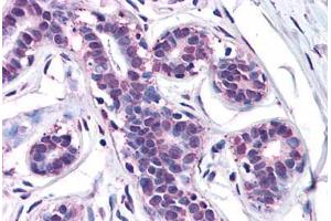 Human Breast: Formalin-Fixed, Paraffin-Embedded (FFPE) (MFI2 anticorps  (N-Term))
