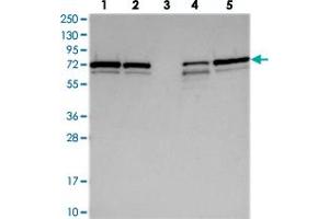 Western blot analysis of Lane 1: RT-4, Lane 2: U-251 MG, Lane 3: Human Plasma, Lane 4: Liver, Lane 5: Tonsil with SNX2 polyclonal antibody  at 1:250-1:500 dilution.