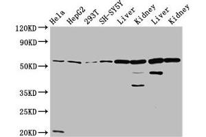 Western Blot Positive WB detected in: Hela whole cell lysate, HepG2 whole cell lysate, 293T whole cell lysate, SH-SY5Y whole cell lysate, Rat liver tissue, Rat kidney tissue, Mouse liver tissue, Mouse kidney tissue All lanes: ALDH7A1 antibody at 4.