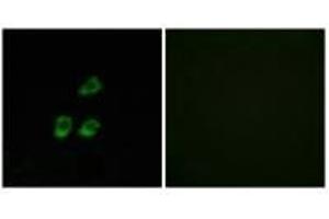 Immunofluorescence analysis of HUVEC cells, using CLCN4 antibody. (CLCN4 anticorps)