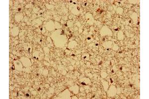 Immunohistochemistry analysis of human brain tissue using ABIN7148523 at dilution of 1:100