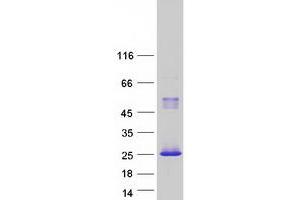 Validation with Western Blot