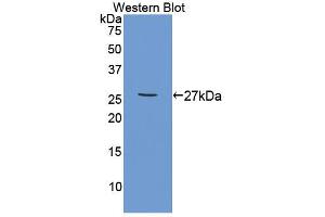Western blot analysis of the recombinant protein. (TNFRSF1B anticorps  (AA 25-229))