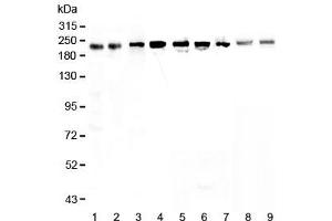 Western blot testing of human 1) HeLa, 2) placenta, 3) MCF7, 4) A549, 5) A431, 6) SGC-7901, 7) 22RV1, 8) rat small intestine and 9) mouse small intestine lysate with BRG1 antibody at 0.