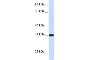 WB Suggested Anti-PBLD Antibody Titration: 0. (PBLD1 anticorps  (N-Term))