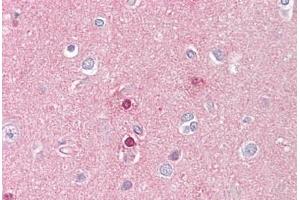 Anti-UBR5 antibody IHC staining of human brain, cortex. (UBR5 anticorps  (AA 1-50))