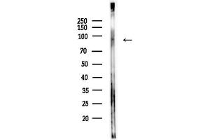 Western blot analysis of lysates from LoVo cells(heat-shock,45 min treatment), using PPM1E Antibody at 1/1000 dilution.