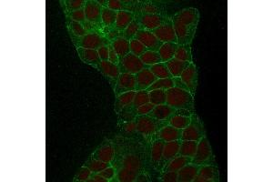 Confocal Immunofluorescence of MCF-7 cells TACSTD2 / TROP2 Mouse Monoclonal Antibody (TACSTD2/2152). (TACSTD2 anticorps  (AA 31-274))