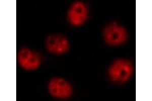 ABIN6269226 staining Hela by IF/ICC.