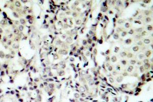 Image no. 1 for anti-Mitogen-Activated Protein Kinase Kinase 3 (MAP2K3) antibody (ABIN265520) (MAP2K3 anticorps)