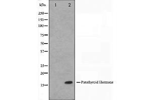 Western blot analysis on A549 cell lysate using Parathyroid Hormone Antibody. (PTH anticorps  (Internal Region))