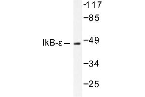Image no. 1 for anti-Nuclear Factor of kappa Light Polypeptide Gene Enhancer in B-Cells Inhibitor, epsilon (NFKBIE) antibody (ABIN265484) (NFKBIE anticorps)