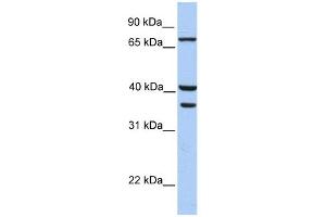 Transglutaminase 5 antibody used at 1 ug/ml to detect target protein. (Transglutaminase 5 anticorps  (C-Term))