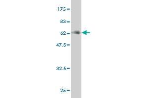 Western Blot detection against Immunogen (59. (MEOX2 anticorps  (AA 1-303))