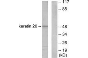 Western blot analysis of extracts from HeLa cells, using Keratin 20 Antibody.