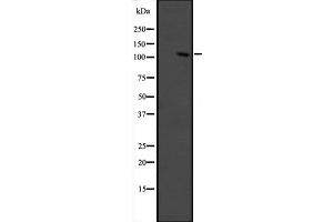 Western blot analysis of GRIP1 expression in fetal muscle lysate ,The lane on the left is treated with the antigen-specific peptide. (GRIP1 anticorps  (Internal Region))