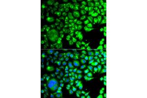 Immunofluorescence analysis of A549 cells using TBPL1 antibody (ABIN5975608). (TBPL1 anticorps)