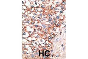 Immunohistochemistry (IHC) image for anti-Gap Junction Protein, alpha 10, 62kDa (GJa10) antibody (ABIN2998438)