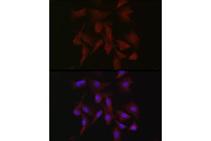 Immunofluorescence analysis of NIH-3T3 cells using PRKCB Rabbit pAb (ABIN6128462, ABIN6146199, ABIN6146201 and ABIN6217699) at dilution of 1:50 (40x lens). (PKC beta anticorps  (AA 1-270))