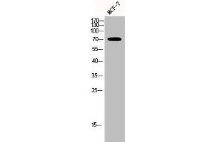 Western Blot analysis of MCF-7 cells using HSP70 Polyclonal Antibody (HSPA1L anticorps  (Internal Region))