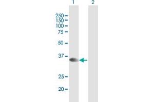 Western Blot analysis of STX16 expression in transfected 293T cell line by STX16 MaxPab polyclonal antibody. (Syntaxin 16 anticorps  (AA 1-304))