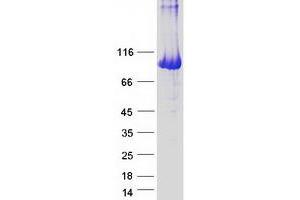 Validation with Western Blot