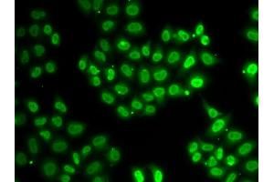 Immunofluorescence analysis of HeLa cells using EWSR1 antibody (ABIN5970844). (EWSR1 anticorps)