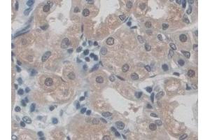 Detection of CD300c in Human Stomach Tissue using Polyclonal Antibody to CD300 Antigen Like Family Member C (CD300c) (CD300c anticorps  (AA 21-183))