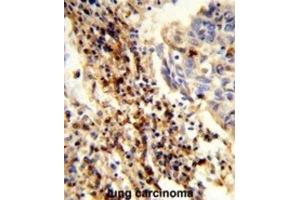 anti-Calponin Homology Domain Containing 2 (CHDC2) antibody