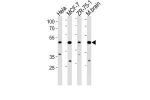 Western Blotting (WB) image for anti-F-Box Protein 28 (FBXO28) antibody (ABIN3004599) (FBXO28 anticorps)