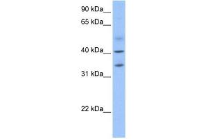 ZC3H14 antibody used at 1 ug/ml to detect target protein. (ZC3H14 anticorps  (N-Term))