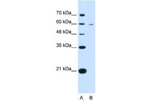 KYNU antibody used at 0. (KYNU anticorps)