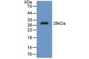WB of Protein Standard: different control antibodies against Highly purified E.