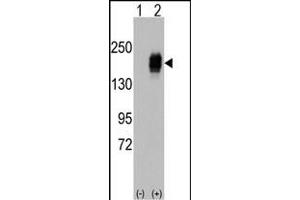 Western blot analysis of EGFR (arrow) using rabbit polyclonal EGFR Antibody i. (EGFR anticorps  (AA 956-985))